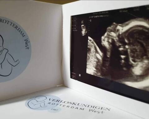 Fun ultrasound Rotterdam 3 foto echo zwart wit